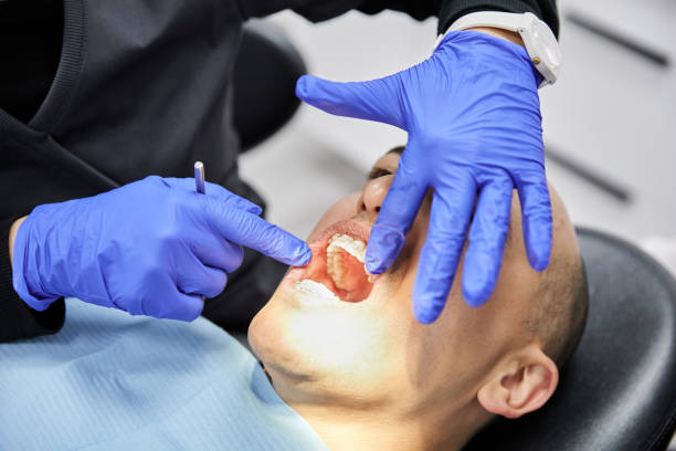 Best Emergency Dental Services for Seniors in Fayette, MS