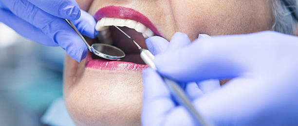 Best Broken or Cracked Tooth Emergency Dentist in Fayette, MS